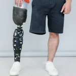 Amputation compensation claim lawyers hero image